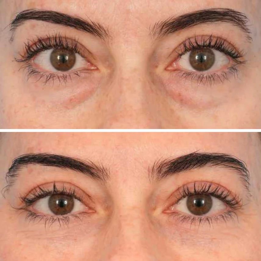 InstaLift™ PDRN & Collagen Eye Patches