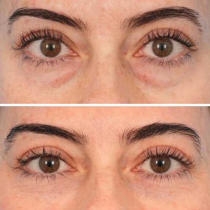 InstaLift™ PDRN & Collagen Eye Patches