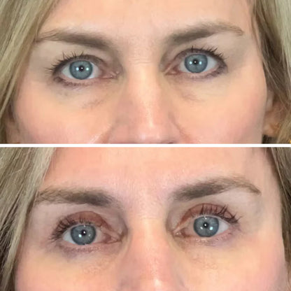 InstaLift™ PDRN & Collagen Eye Patches