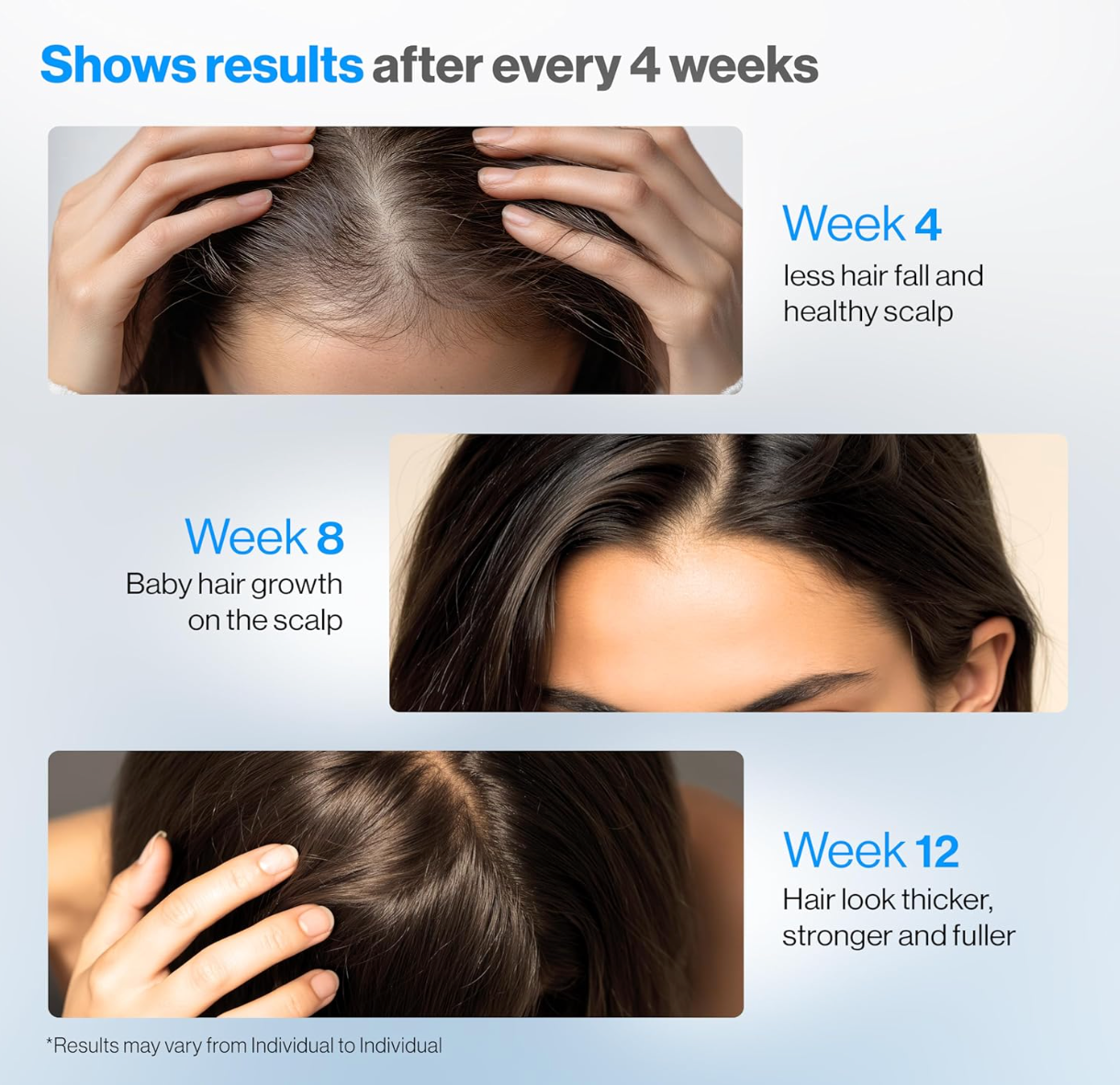RootRevive™ Hair Growth Serum