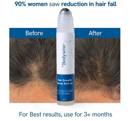 RootRevive™ Hair Growth Serum