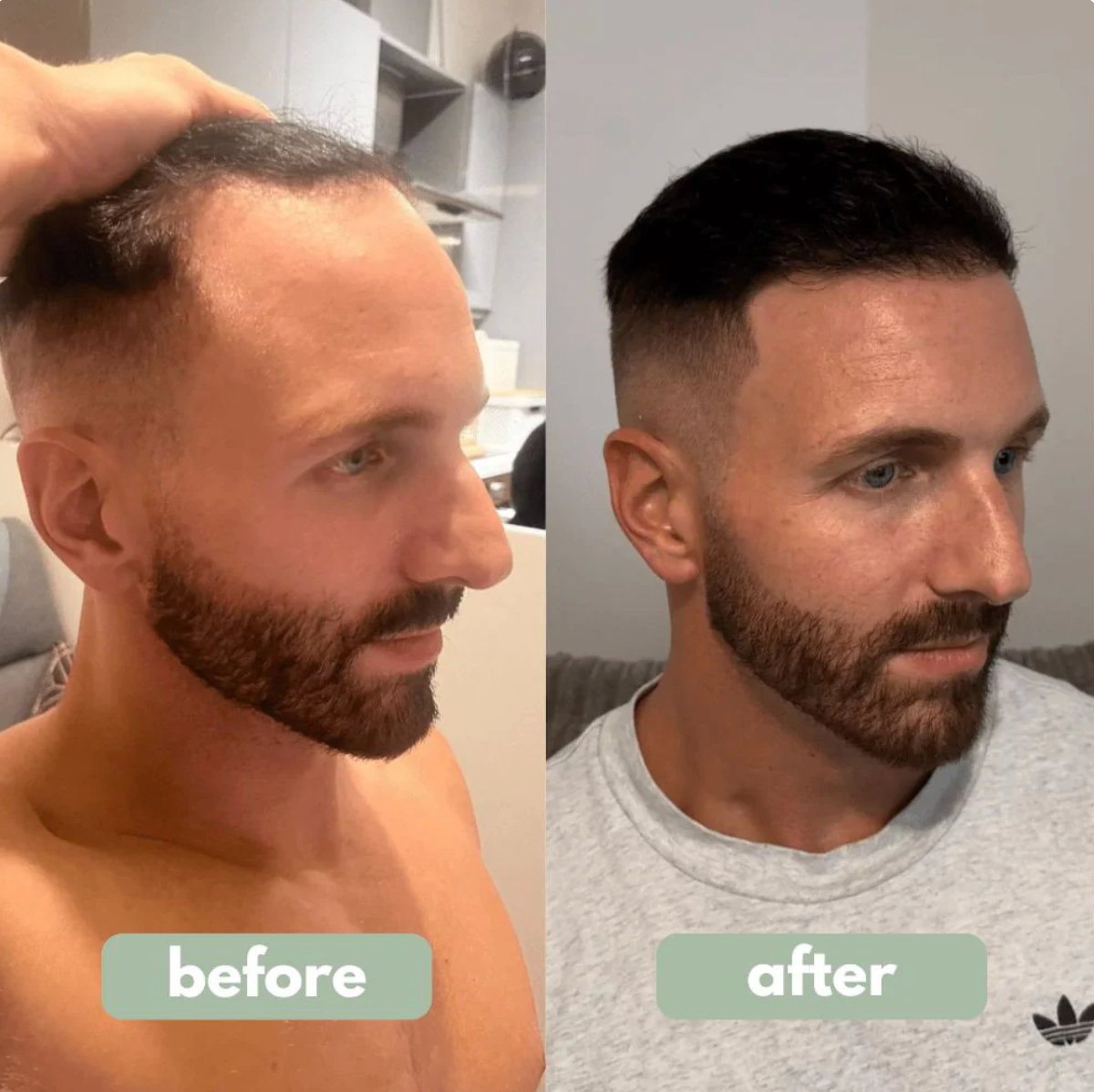 RootRevive™ Hair Growth Serum