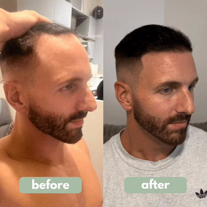 RootRevive™ Hair Growth Serum
