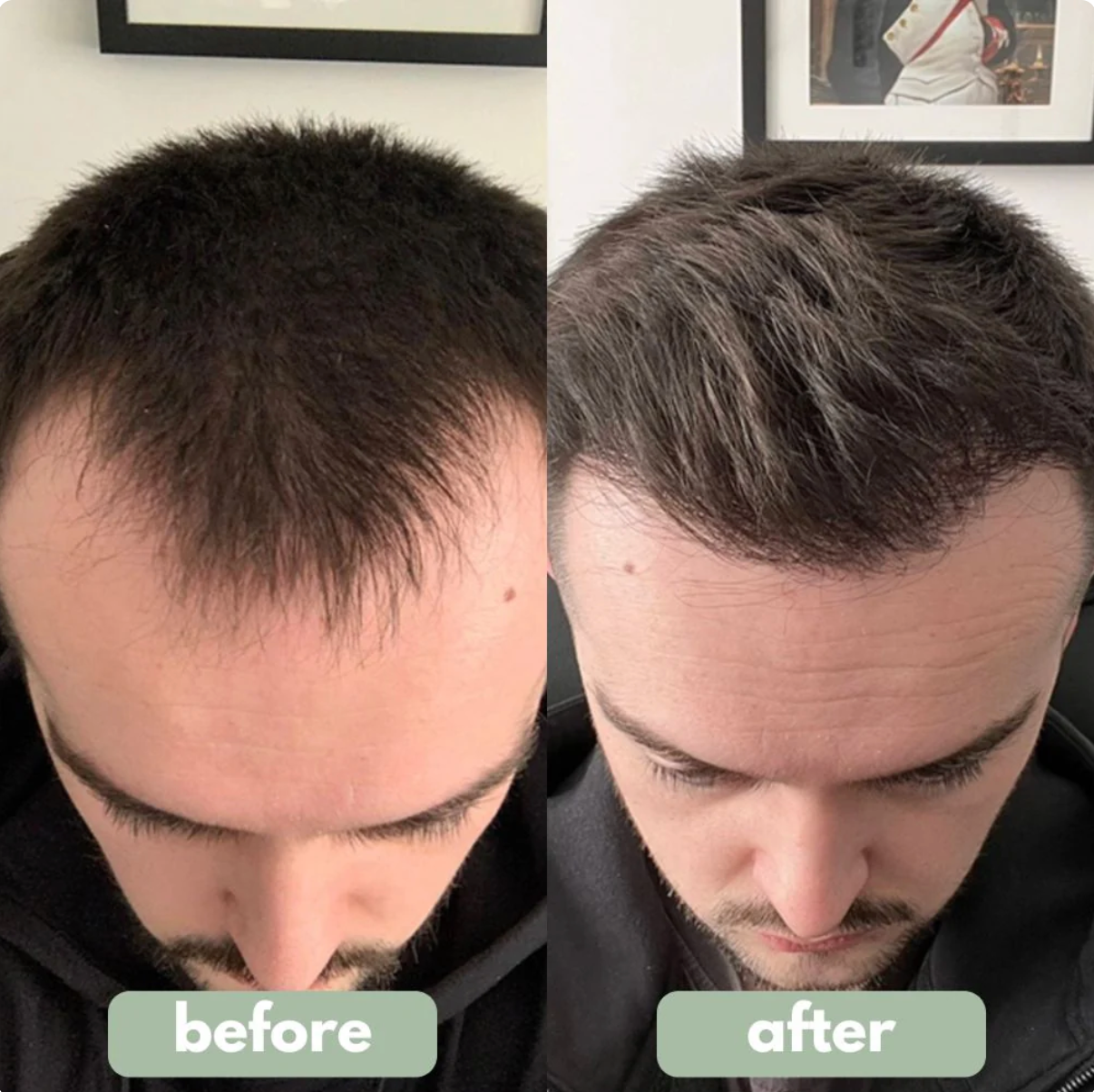 RootRevive™ Hair Growth Serum