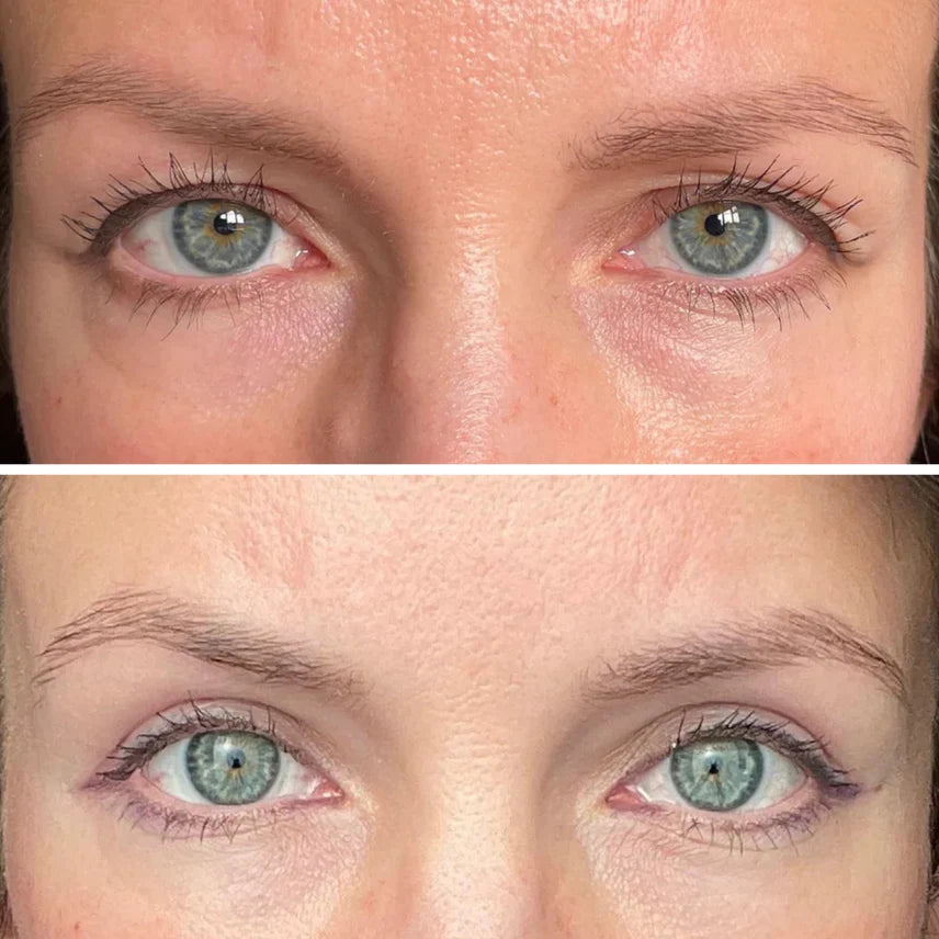 InstaLift™ PDRN & Collagen Eye Patches