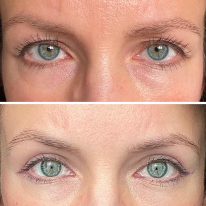 InstaLift™ PDRN & Collagen Eye Patches