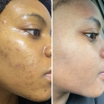 Velouré™ GHK-Cu Copper Peptide Serum